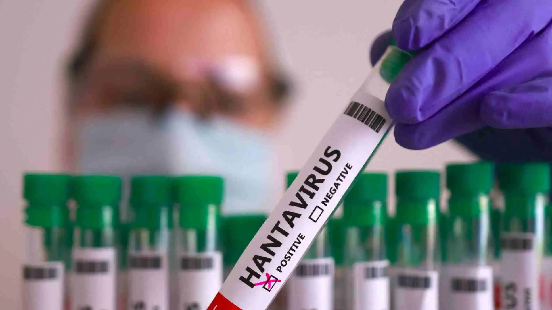 Alentadora vacuna chilena contra el hantavirus que busca fondos para avanzar en humanos